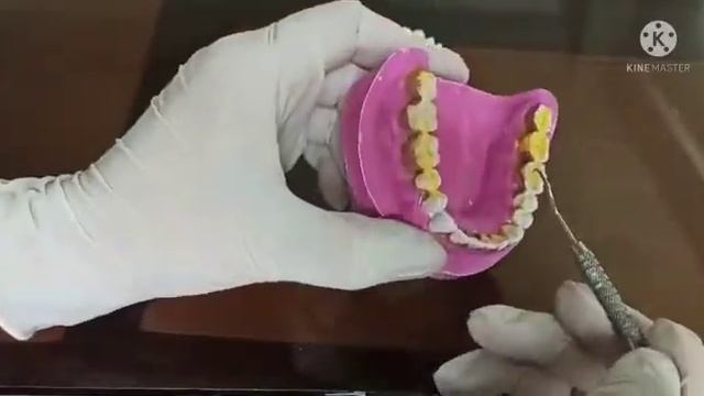 ORAL HYGIENE INDEX - SIMPLIFIED - BY DR. RUQAYYA SANA смотреть онлайн