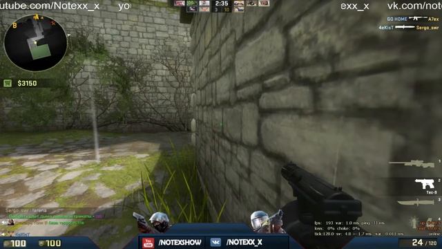 Вопросы в CS:GO | Почему одно яичко больше другого? смотреть онлайн