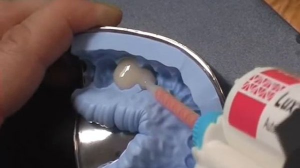 DMG - Luxatemp (Video 1)