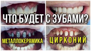 Что выбрать, металлокерамику или цирконий. Имплантация зубов.