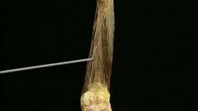 Анатомия коленного сустава - видеоатлас Акланда смотреть онлайн