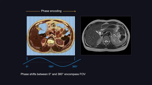 Introduction to Clinical MRI Physics (part 3 of 3) смотреть онлайн