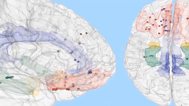 Как в мозге ОТКЛЮЧАЕТСЯ радость ? смотреть онлайн