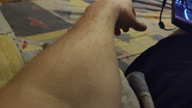 спазм#фасцикуляция