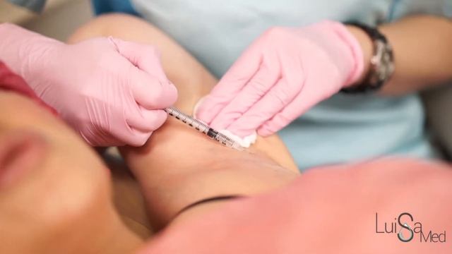 Ботулинотерапия потовых желез