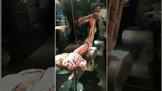 BODY WORLD AMSTERDAM MUSEUM.LIVE смотреть онлайн