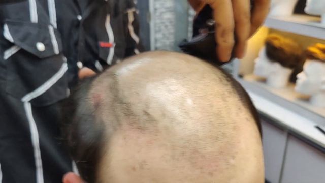 Mens Undercut Hairstyle | Best Hair Patch Style | Permanent Hair Patch #hairpatch смотреть онлайн