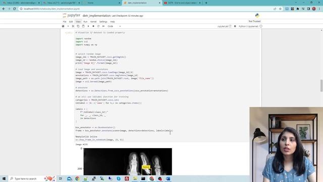 Object detection Using Detection Transformer (Detr) on custom dataset смотреть онлайн