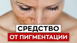 Как сделать кожу лица чистой? / Как убрать пигментные пятна дома?