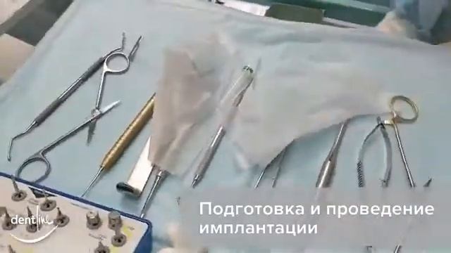 Имплантация зубов видео в Махачкале