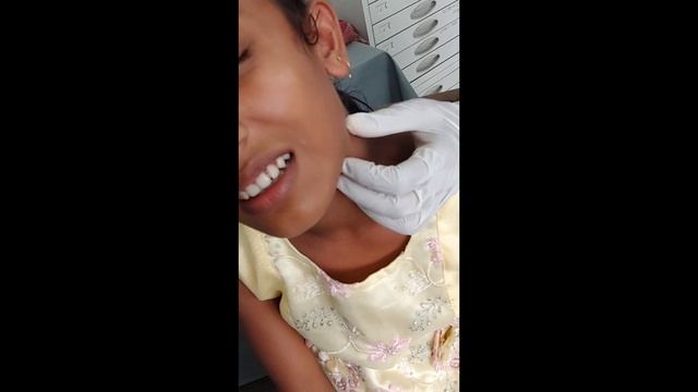 FNAC Of Cervical Lymph Nodes।। смотреть онлайн