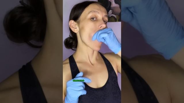 Как убрать Носогубку #массаж