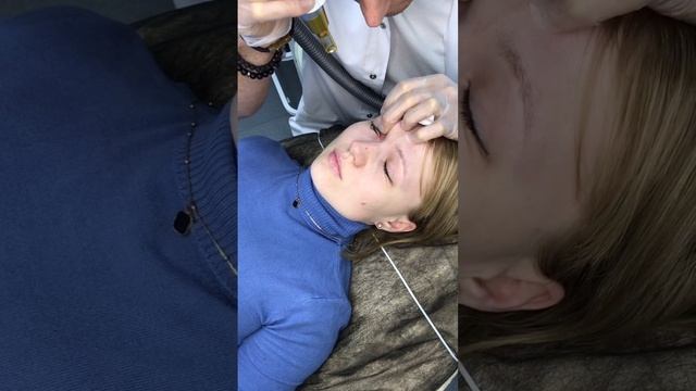 Удаление татуажа век #удалениетатуажа#удалениетатуажанижнийновгород смотреть онлайн