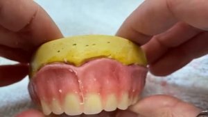 Моделировка съёмного протеза