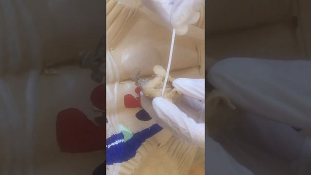 Перешеек ромбовидного мозга. IV желудочек. Ромбовидная ямка.