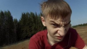 Прыщ на лбу! ШОК! СМОТРЕТЬ ВСЕМ!!!