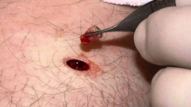 ЧТО БУДЕТ ЕСЛИ СОДРАТЬ РОДИНКУ смотреть онлайн