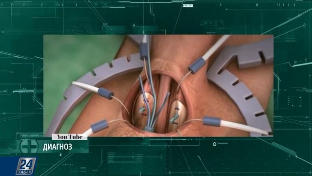 ЭРЕКТИЛЬДІ ДИСФУНКЦИЯ: ҚУАТЫН ЖОҒАЛТҚАН ЕР АДАМДАРҒА ҚАЗІР ҚАЛАЙ КӨМЕКТЕСЕДІ?