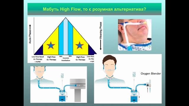 Коли інтубувати при тяжкій вірусній пневмонії і чи є альтернативи до інтубації. М.М. Пилипенко смотреть онлайн