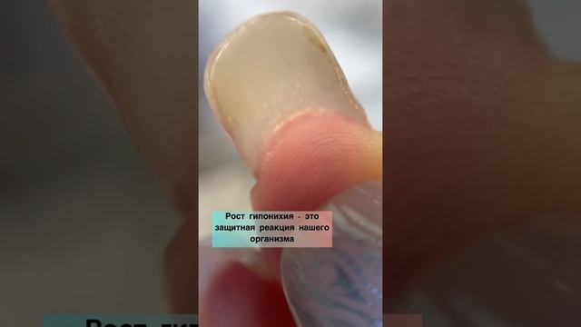 Маникюр#покрытиегельлак#гипонихий#екатеринбургманикюр#маникюрздесьисейчас#маникюрфренч смотреть онлайн