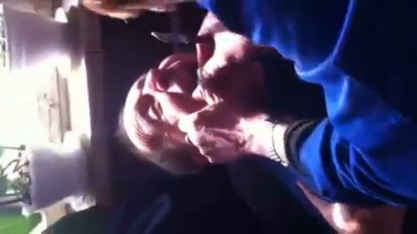 Жесть!!вырывание зуба!!