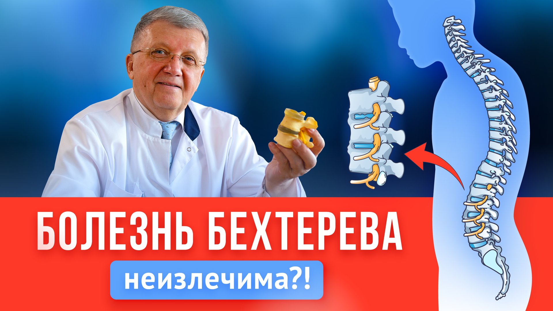 Болезнь Бехтерева НЕ ПРИГОВОР? Симптомы, лечение, профилактика, упражнения смотреть онлайн