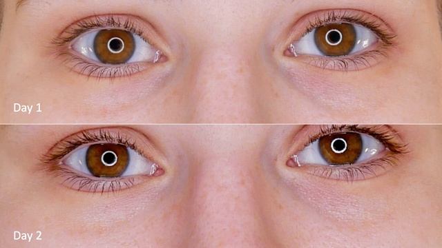 Avene Soothing Eye Contour Cream | Before & After смотреть онлайн