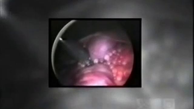 This little pig went to market - Xenotransplantation смотреть онлайн