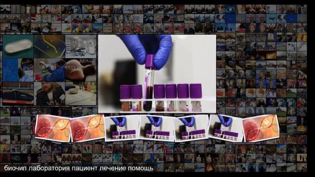 Российская тест-система сможет распознать рак на самой ранней стадии смотреть онлайн