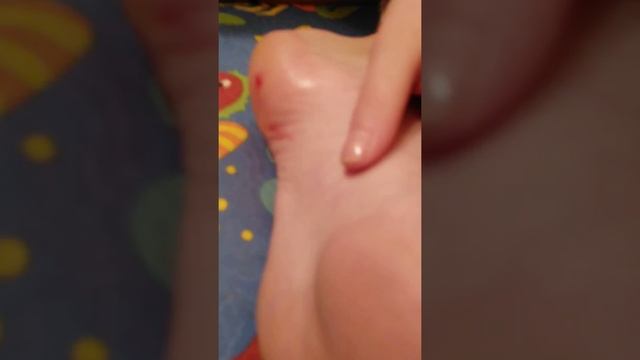 У сестры застряло стекло в пятке смотреть онлайн