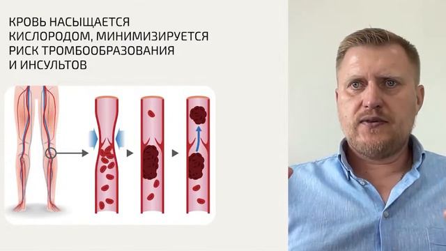 Как снизить РИСК ИНСУЛЬТО? Ученые провели эксперимент на кроликах смотреть онлайн