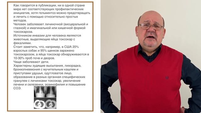 Причиной болезни может быть токсокароз смотреть онлайн