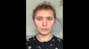 Таймлапс Роста Волос