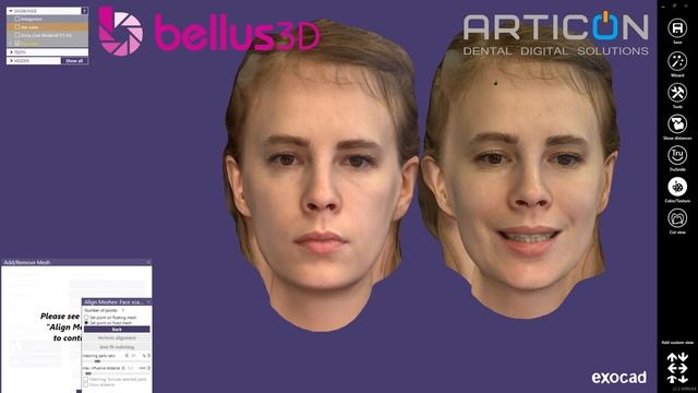 Интеграция скана лица(Bellus3D) в программу Exocad. Наиболее точный протокол. смотреть онлайн