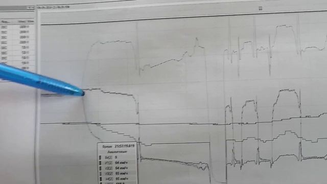 Боксование-юз. Реальное или датчики. Реальное - предотвращаем. Датчики ДПС проблемы! смотреть онлайн
