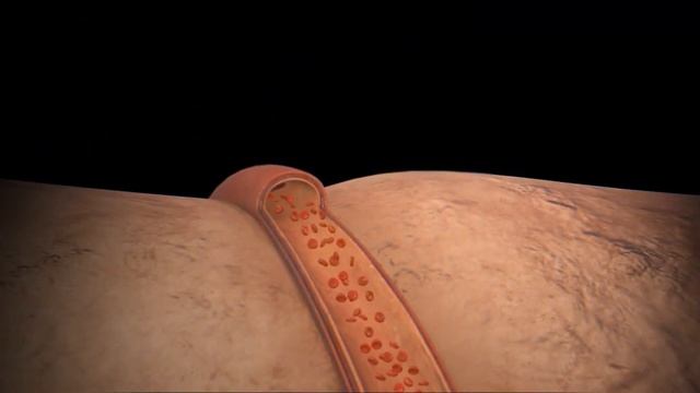 Продукты, вредные для почек смотреть онлайн