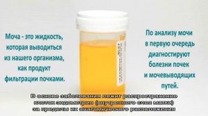 Кровь в моче у женщин