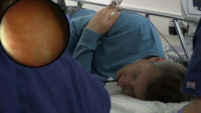 Transnasal Procedure V1  1024x576 H264 HQ