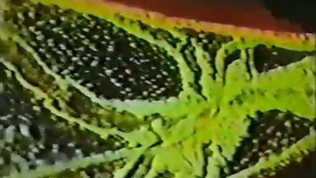 Движение лимфы (учебный фильм) смотреть онлайн