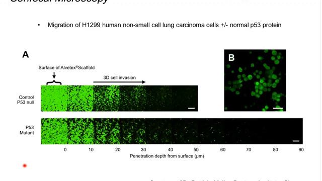 How to Model Cancer Cell Invasion Using Novel 3D Cell Culture Technology | REPROCELL (Alvetex) смотреть онлайн