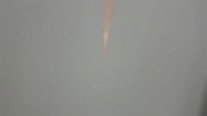 Что случилось?/ Обследование в МОСКВЕ/ ЭЭГ-МОНИТОРИНГ/ Эпилепсия, ДЦП