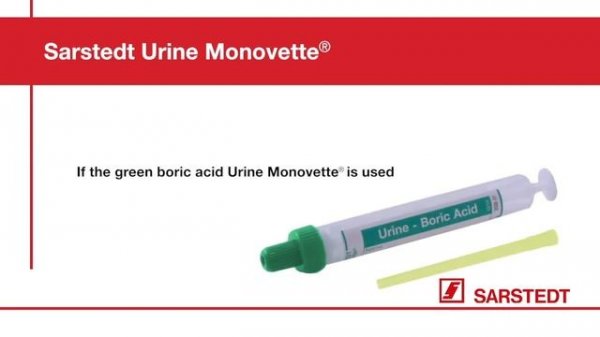 Urine collection: Instruction for hygenic urine collection with the Urine Monovette®