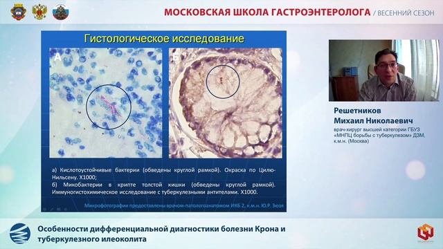 Доклад Решетникова М. Н. Особенности дифференциальной диагностики болезни Крона смотреть онлайн