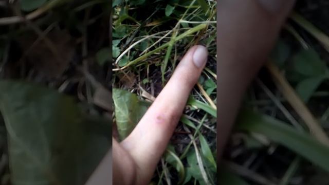 Заживление ранки на пальце смотреть онлайн