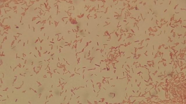 Moraganella morganii in Gram Staining смотреть онлайн