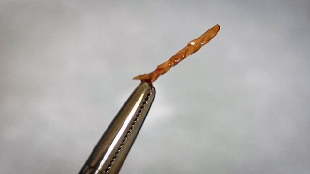 Eardrum Foreign Body | Auburn Medical Group смотреть онлайн