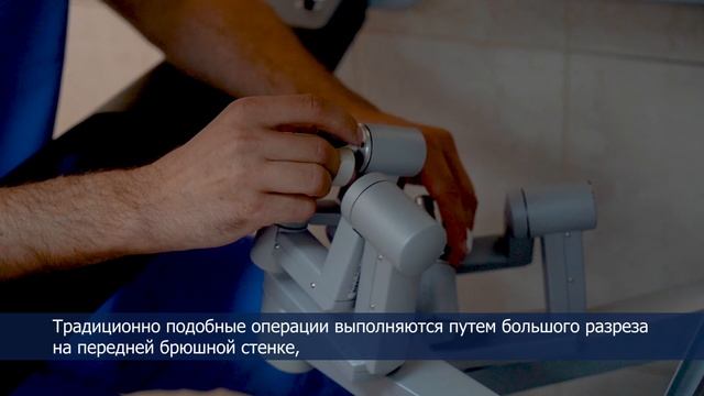 Операция с помощью робота da Vinci смотреть онлайн