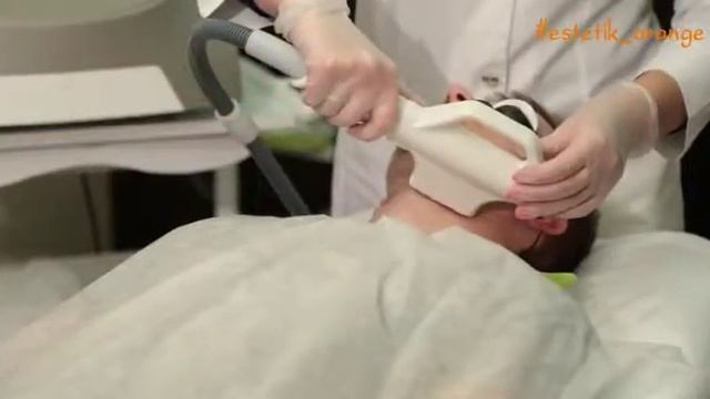 Процедура фотоэпиляции смотреть онлайн