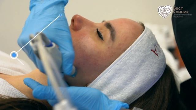 ✅ВАКУУМНАЯ ЧИСТКА HydraFacial.