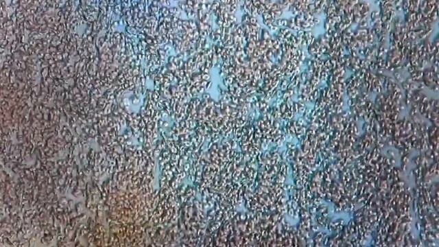 еритроцити в 720р смотреть онлайн